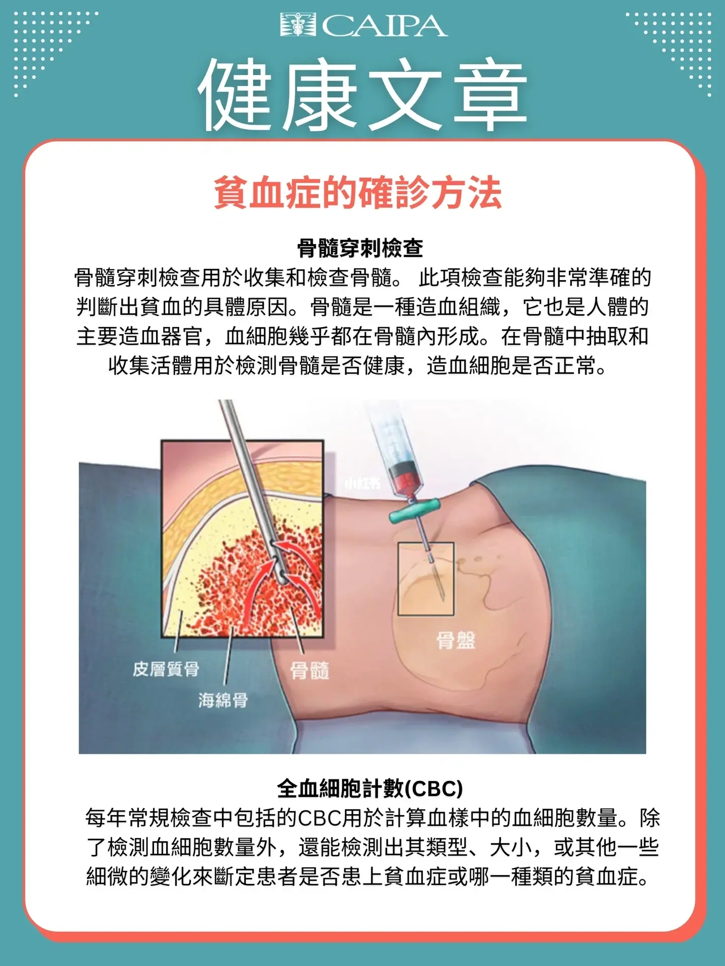 健康文章 - 貧血症